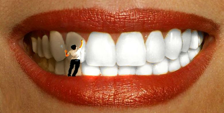 Почему образуется желтый налет на зубах и как от него избавиться
