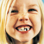 Молочные зубы у ребенка